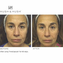 Load image into Gallery viewer, HUSH & HUSH TimeCapsule®️