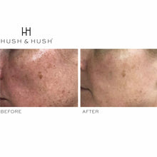 Load image into Gallery viewer, HUSH &amp; HUSH SkinCapsule™ BRIGHTEN+
