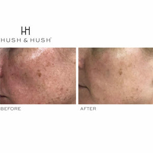 HUSH & HUSH SkinCapsule™ BRIGHTEN+