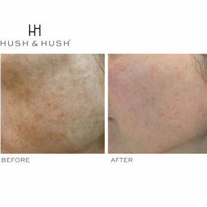 HUSH & HUSH SkinCapsule™ BRIGHTEN+